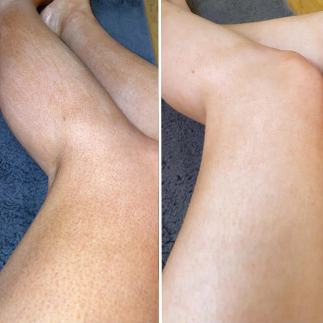 Old / Fake Tan