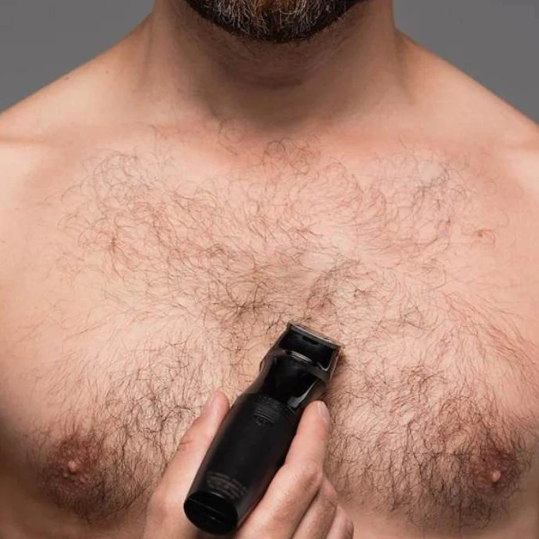 Sissekasvanud karvad