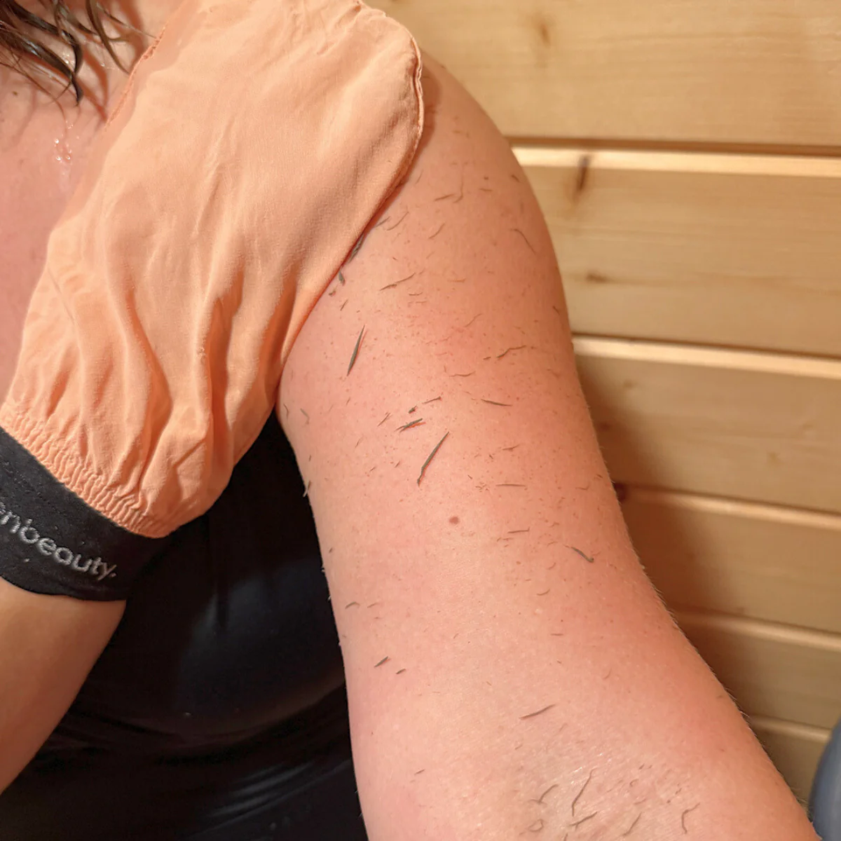 Dead skin lifting off after using a silk exfoliating glove — key to clearing butt acne and folliculitis